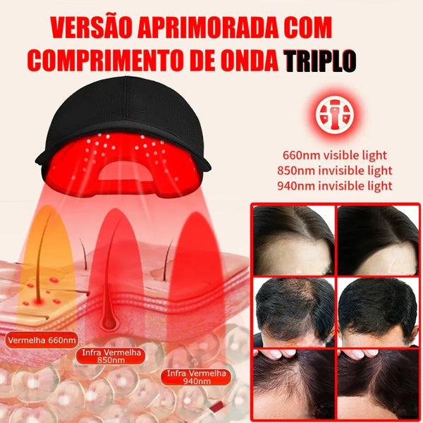 CAPILUS PRO™ Boné de LED Terapia Capilar Profissional
