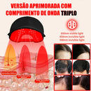 CAPILUS PRO™ Boné de LED Terapia Capilar Profissional
