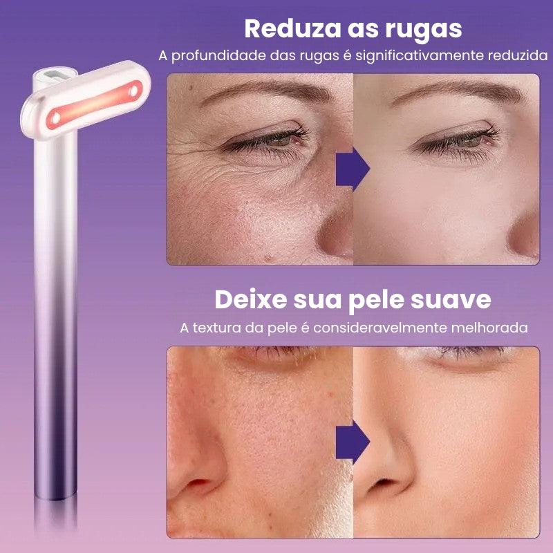 FLIX™ Bastão de LED Terapia Facial Anti Rugas - VitaLux